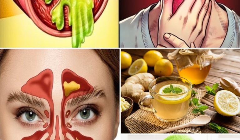 4 Effective Home Remedies to Eliminate Mucus and Phlegm from the Throat, Sinusitis, and Rhinitis