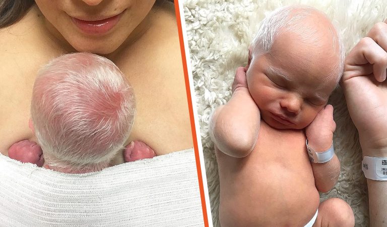 Albino baby mocked for white hair is happy and healthy years later