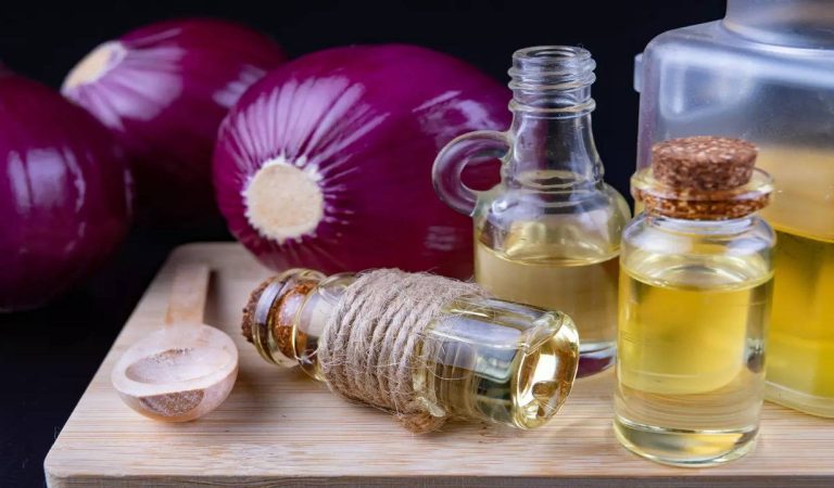 Onion and Coconut Oil Can Take You From Hair Loss to Hair Goals