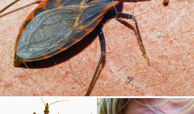 Unwanted Summertime Guests: The Rise of Kissing Bugs