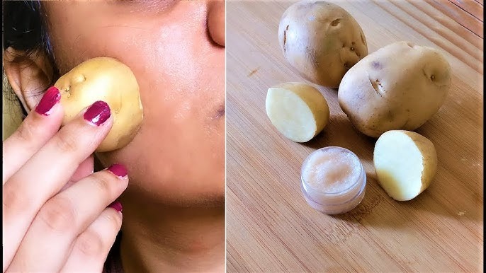 Discover Amazing Potato Skincare Remedies for Naturally Glowing Skin