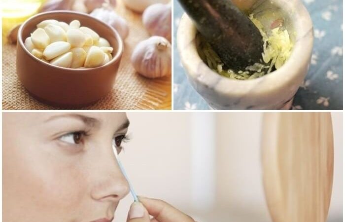 Say Goodbye to Unwanted Hair with The Power of Hair Removal Using Garlic