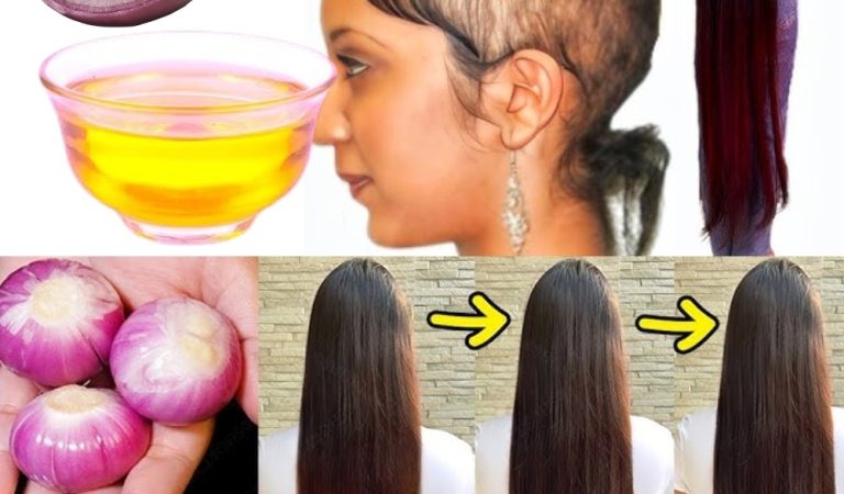 The Hair Growth Secret Hiding in Your Kitchen: How to Make Onion Oil That Transforms Your Hair