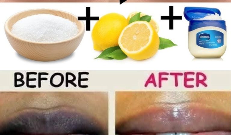 Rub This on Your Lips: I Got Super Soft, Pink Lips With No Pigmentation—Thanks to This One Slice!
