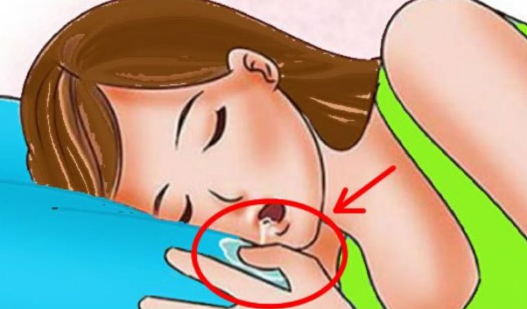 If you regularly drool while sleeping, get it checked out right away